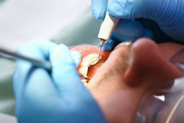 Best Tooth Pain Emergency Relief  in University Park, TX